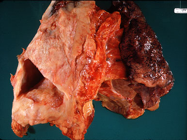 what is abatement of asbestos