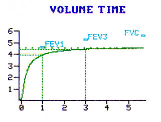 Predicted Peak Flow Chart