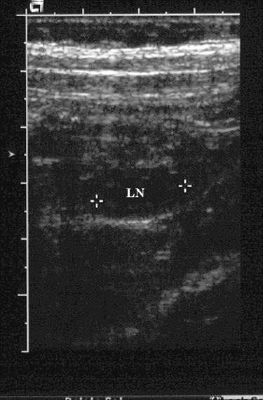 férgek és mesenterialis adenitis in)