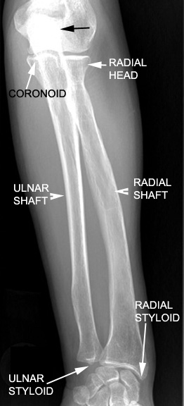 Try to identify the following