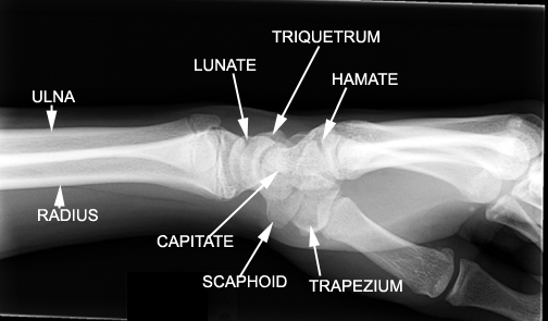 Try to identify the following