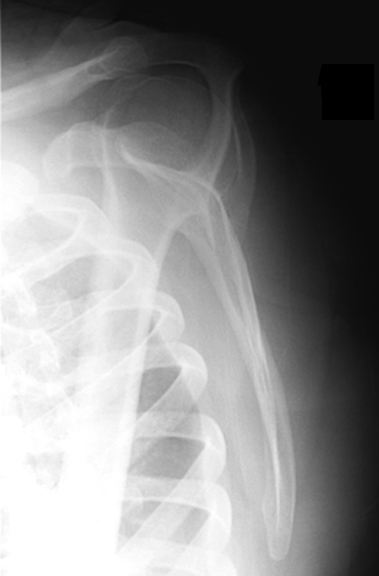 Try to identify the following