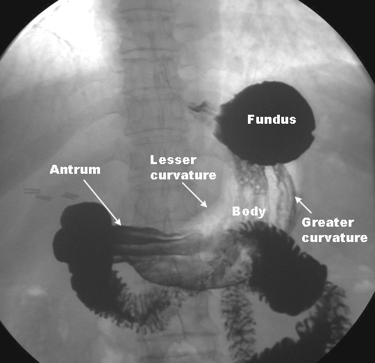 Course of Esophagus