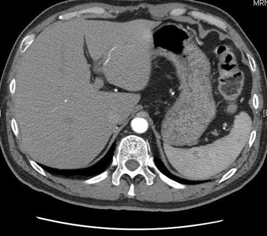 Identify the diaphragm. Click the image for labeling.