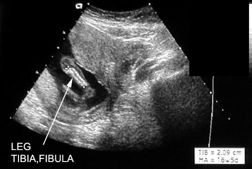 Mammography objectives
