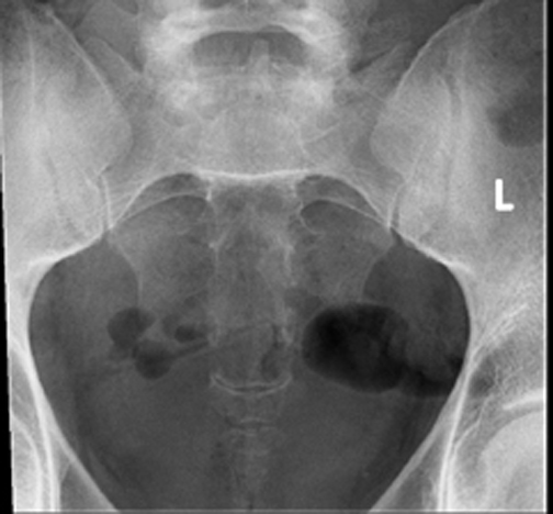 Identify parts of the sacrum and coccyx. Click the image for labeling.