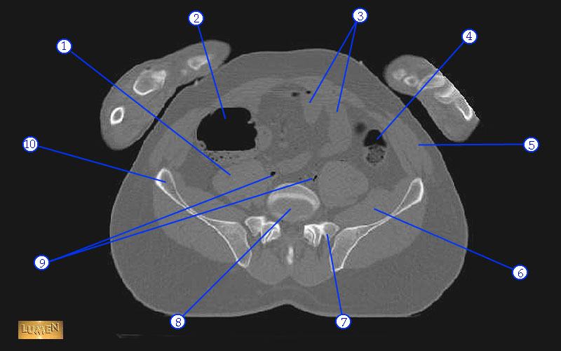 sagittal cross section of pelvis