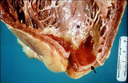 L:\MedEd\Pathology\gross\gross01.html L:\MedEd\Pathology\gross\gross01.html
