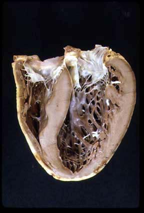 L:\MedEd\Pathology\gross\gross01.html L:\MedEd\Pathology\gross\gross01.html