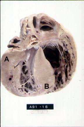 L:\MedEd\Pathology\gross\gross01.html L:\MedEd\Pathology\gross\gross01.html
