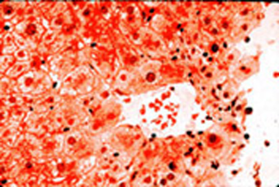 100 mg clomid day 1-5 twins 100 mg clomid day 1-5 twins