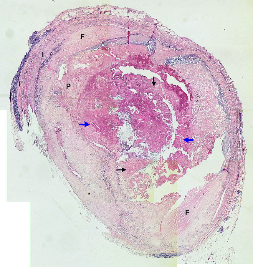 L:\MedEd\Pathology\gross\gross01.html L:\MedEd\Pathology\gross\gross01.html