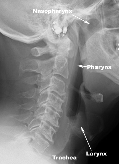 pharynx larynx trachea