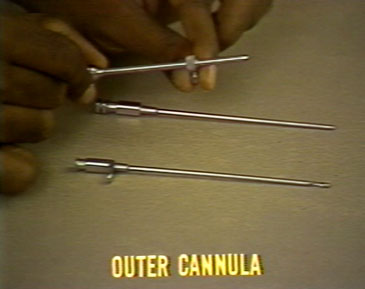 There are four parts to the Cope needle.