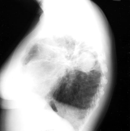 20bl.JPG (17903 bytes)