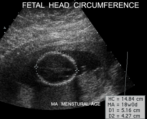 Image Atlas Of Normal Pregnancy Image Atlas Of Normal Pregnancy